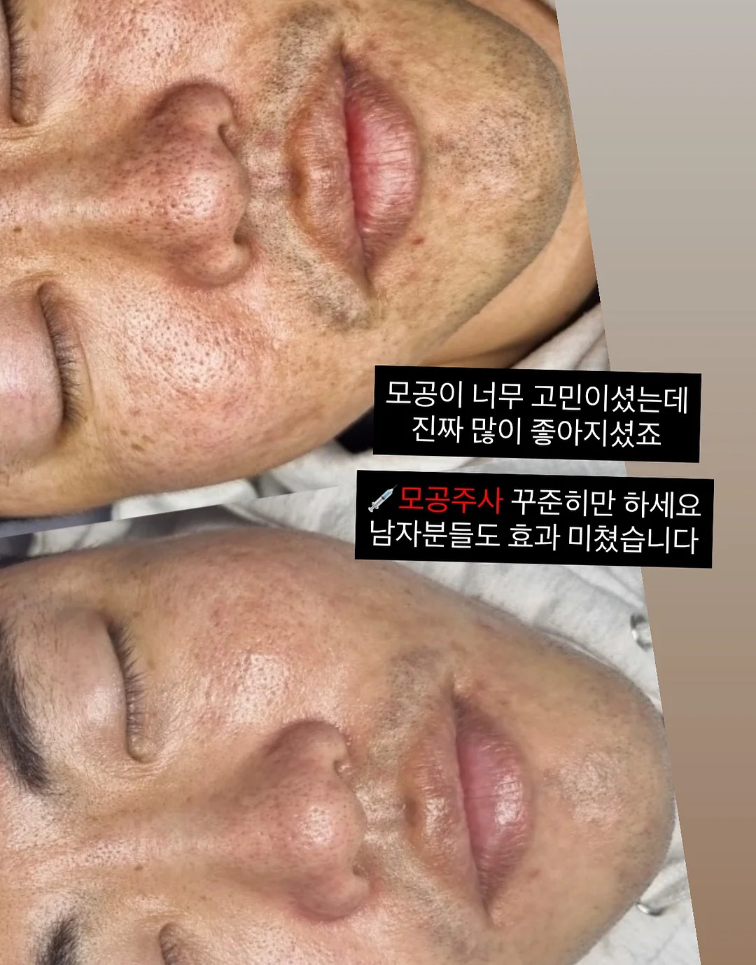 성인 플리츠 세트 12