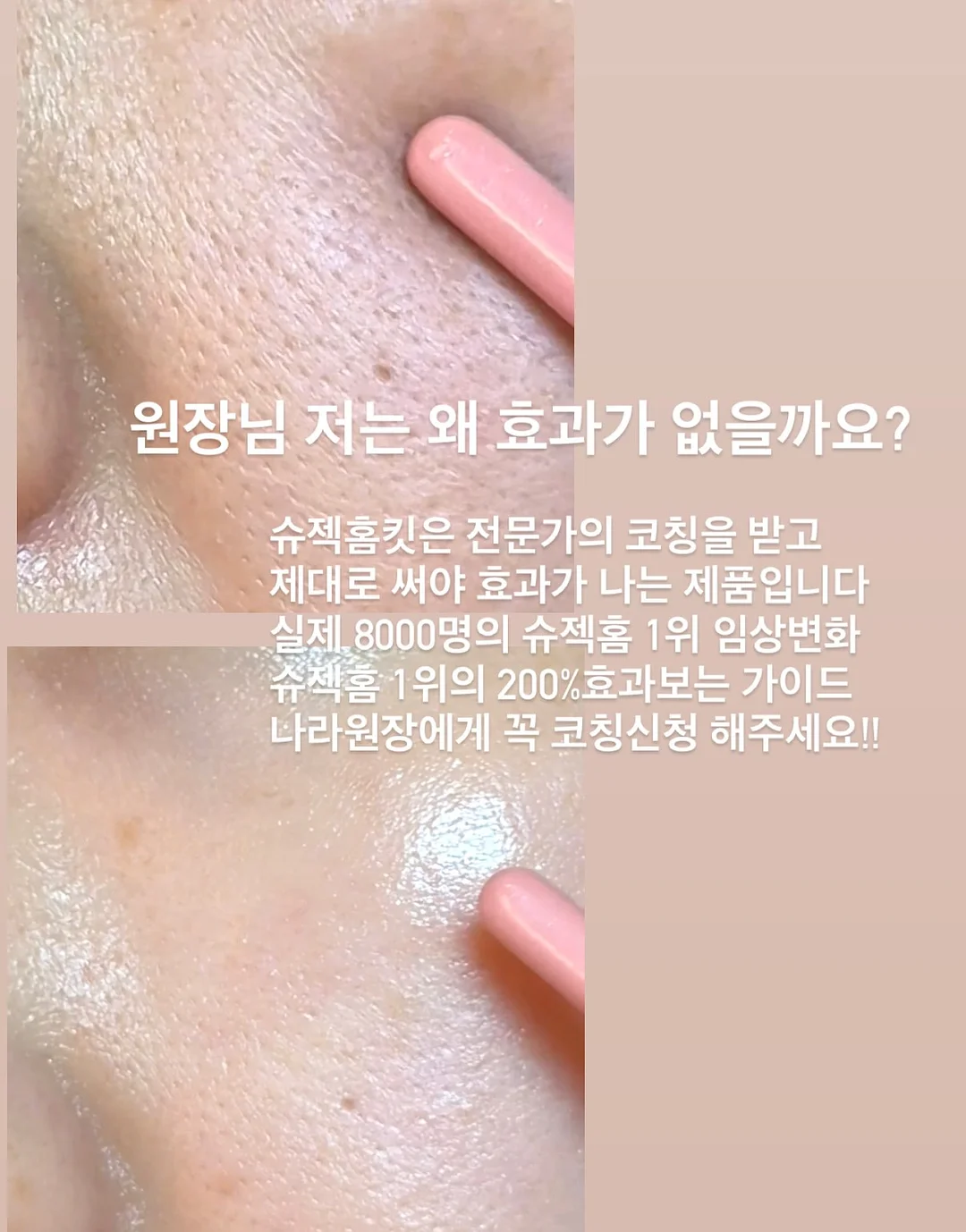 성인 플리츠 세트 15