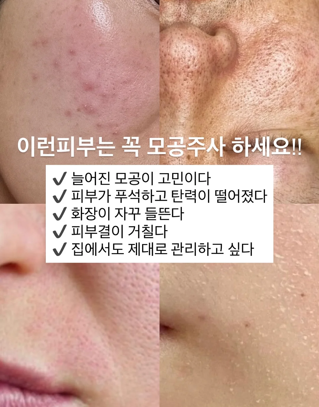 성인 플리츠 세트 2