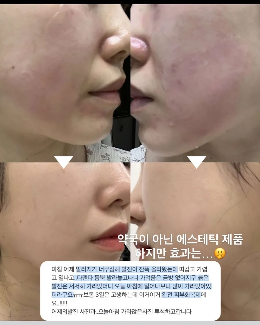 데이핏 웨지 쪼리 6
