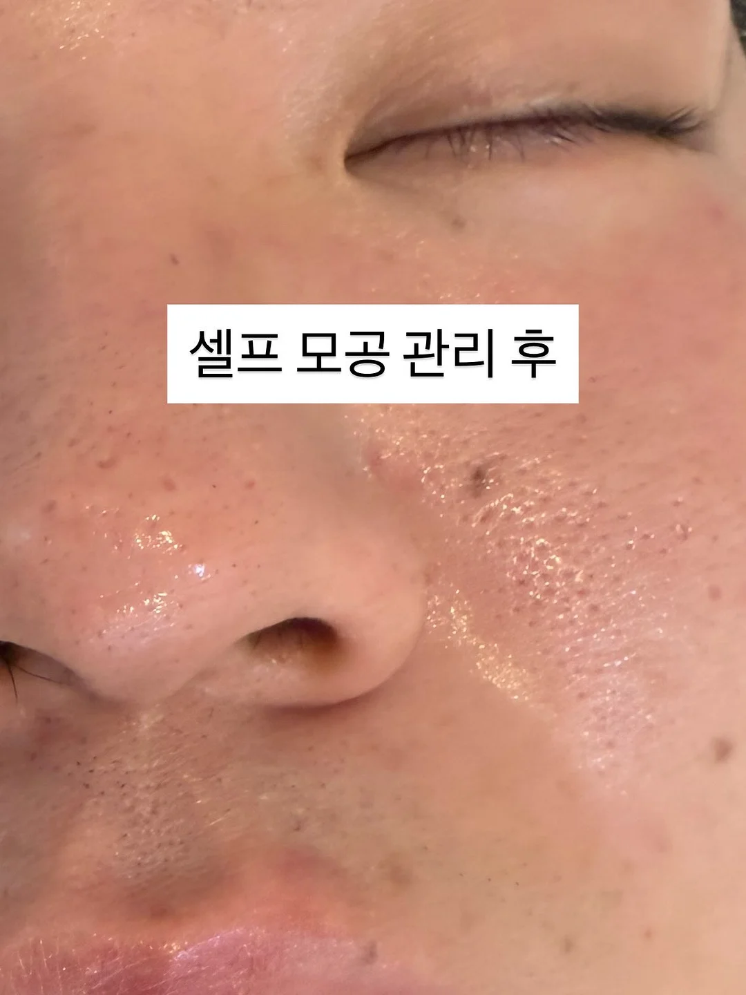 체리 체험 농원 2