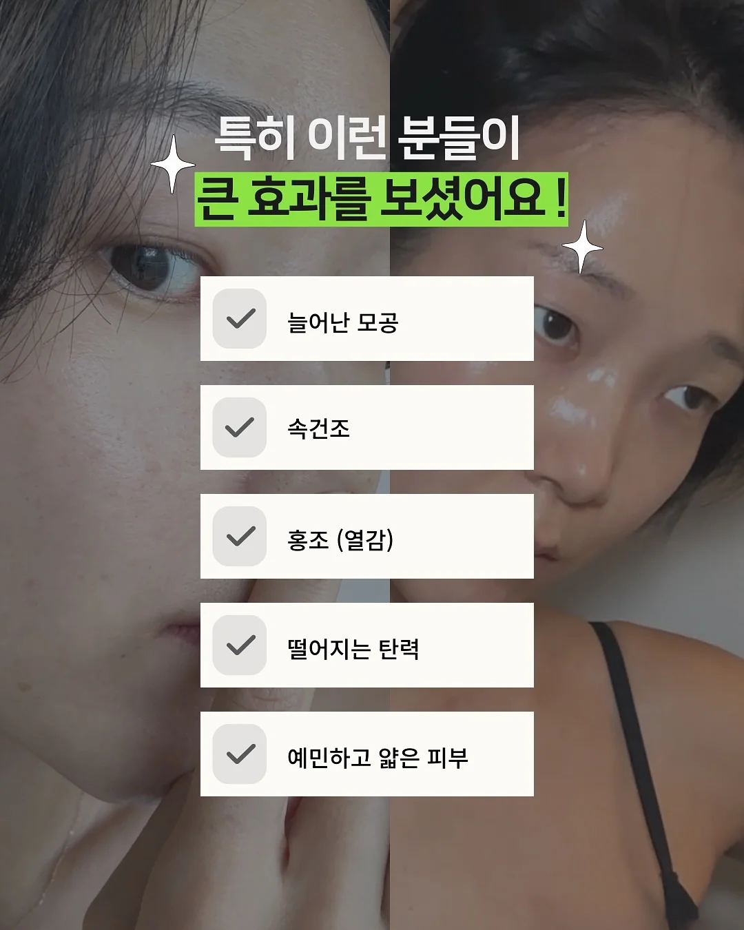 무스비 4