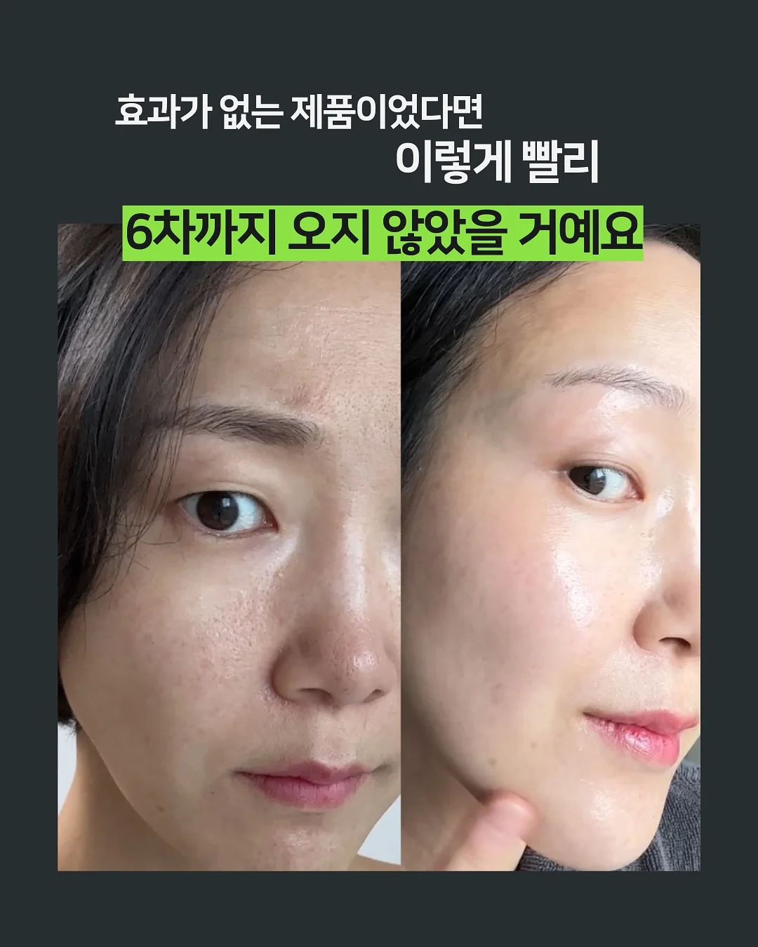 무스비 5