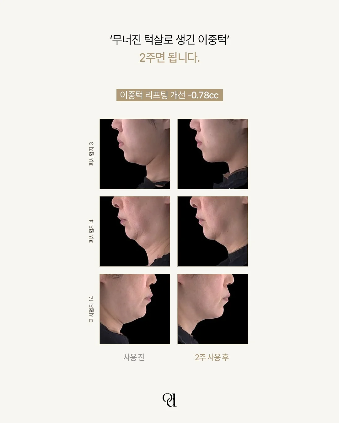 크런틴 말차 크런치볼 2