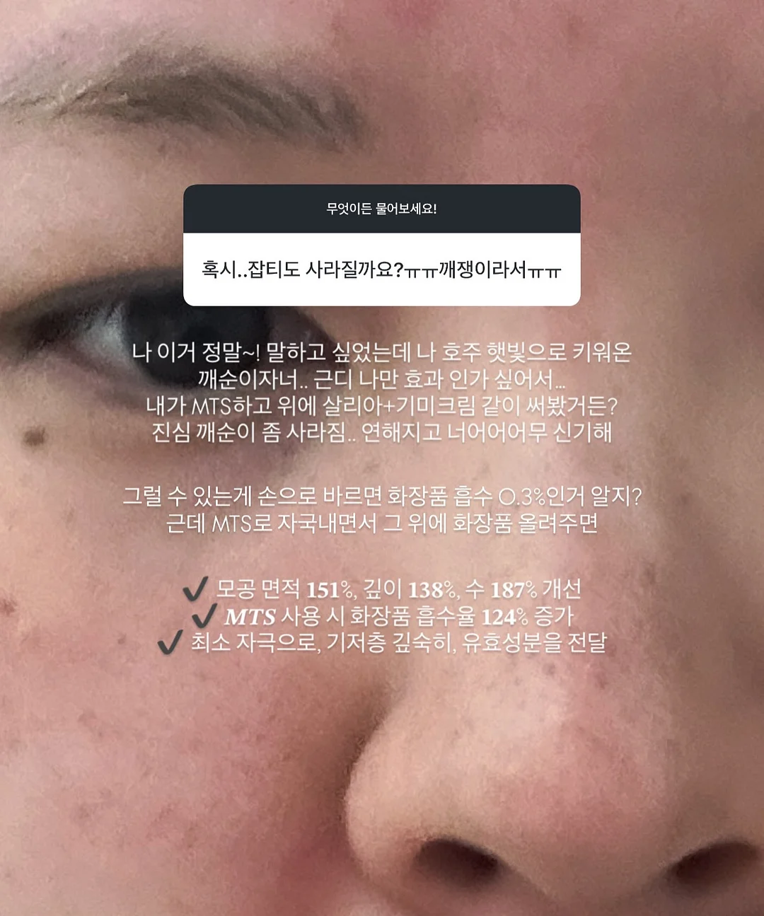아코야 듀얼귀걸이 6