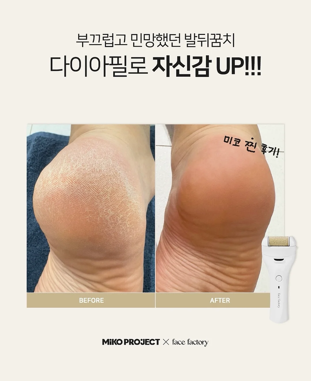 러너 1