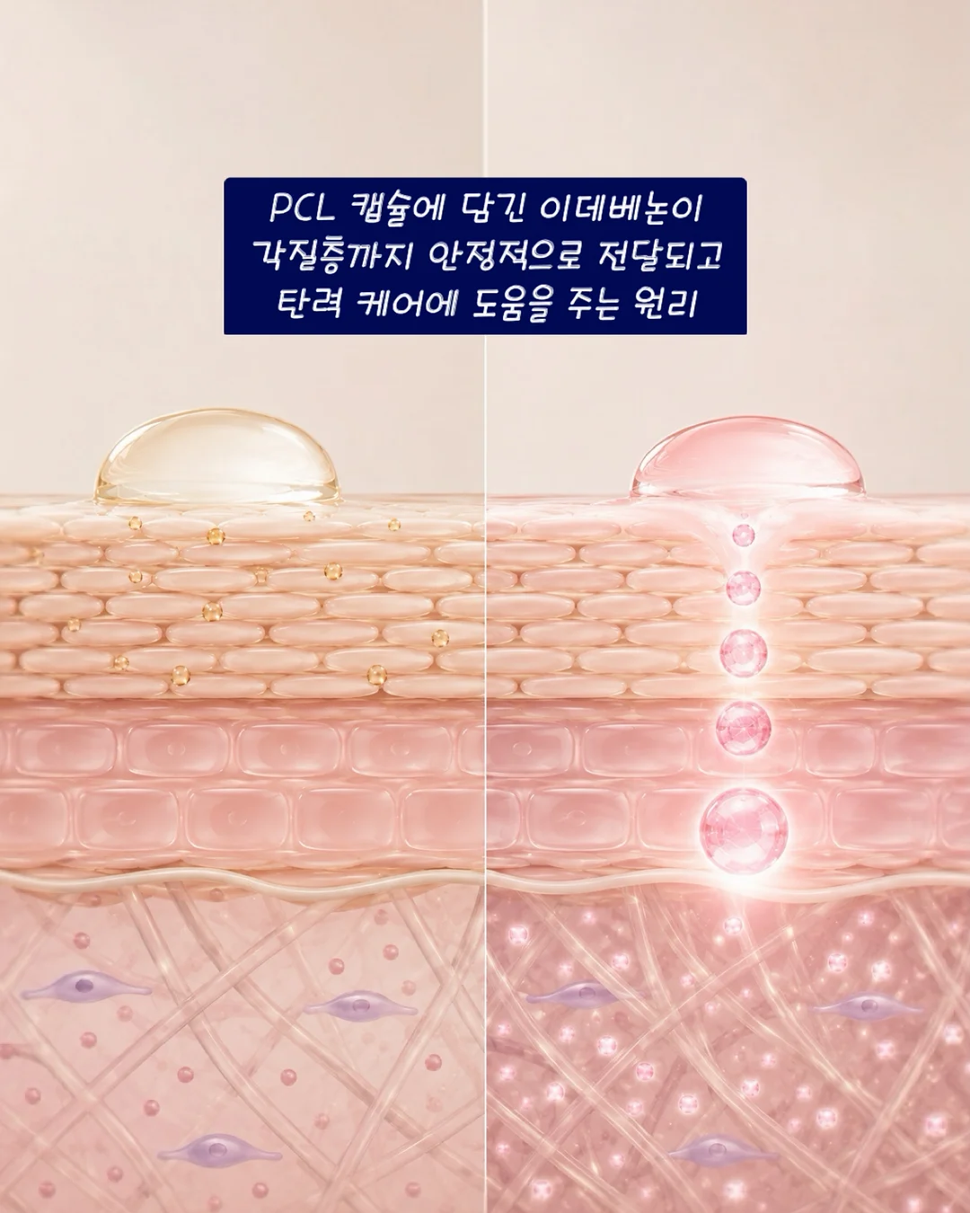 스티치셔츠 7
