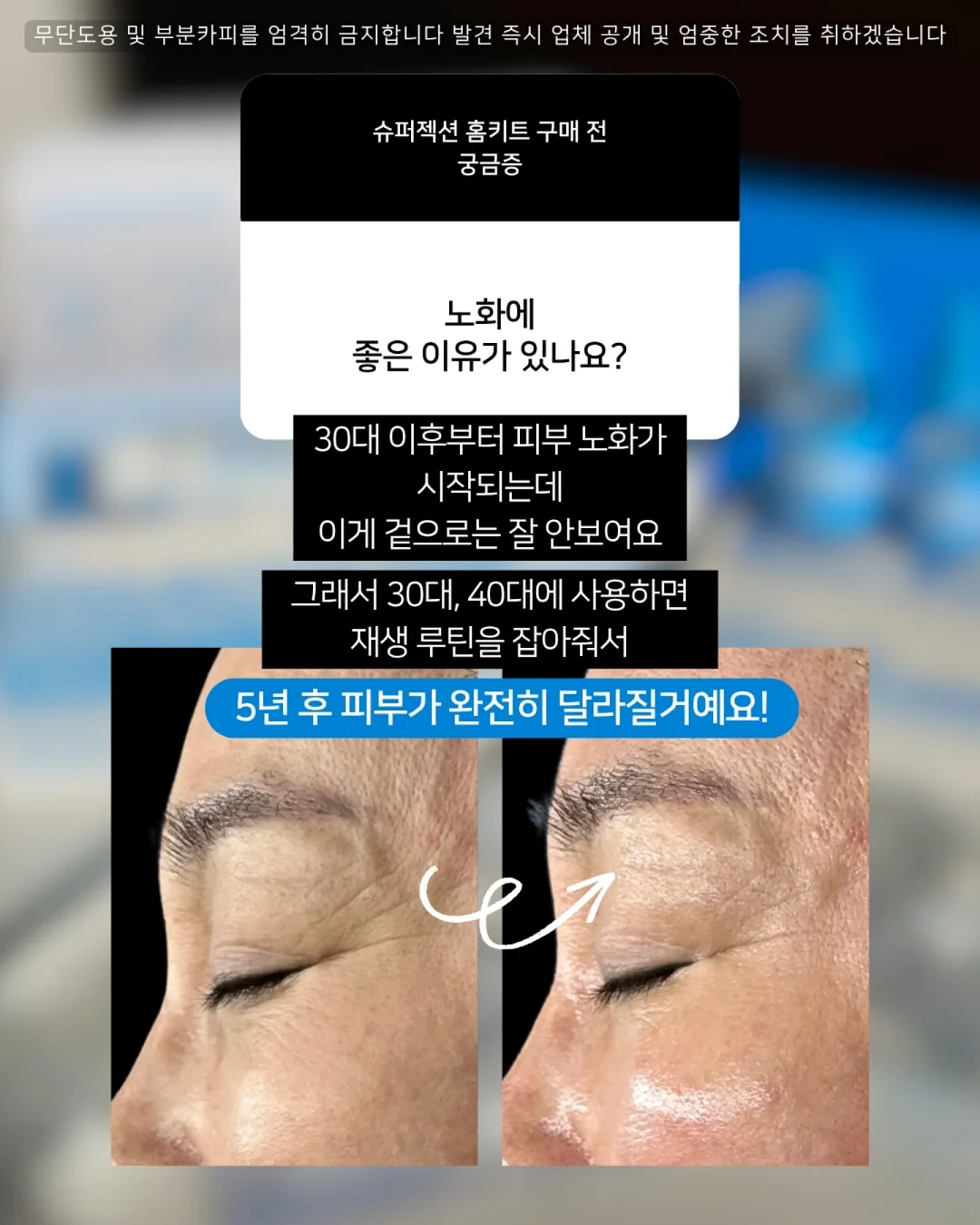 패디 아트 5