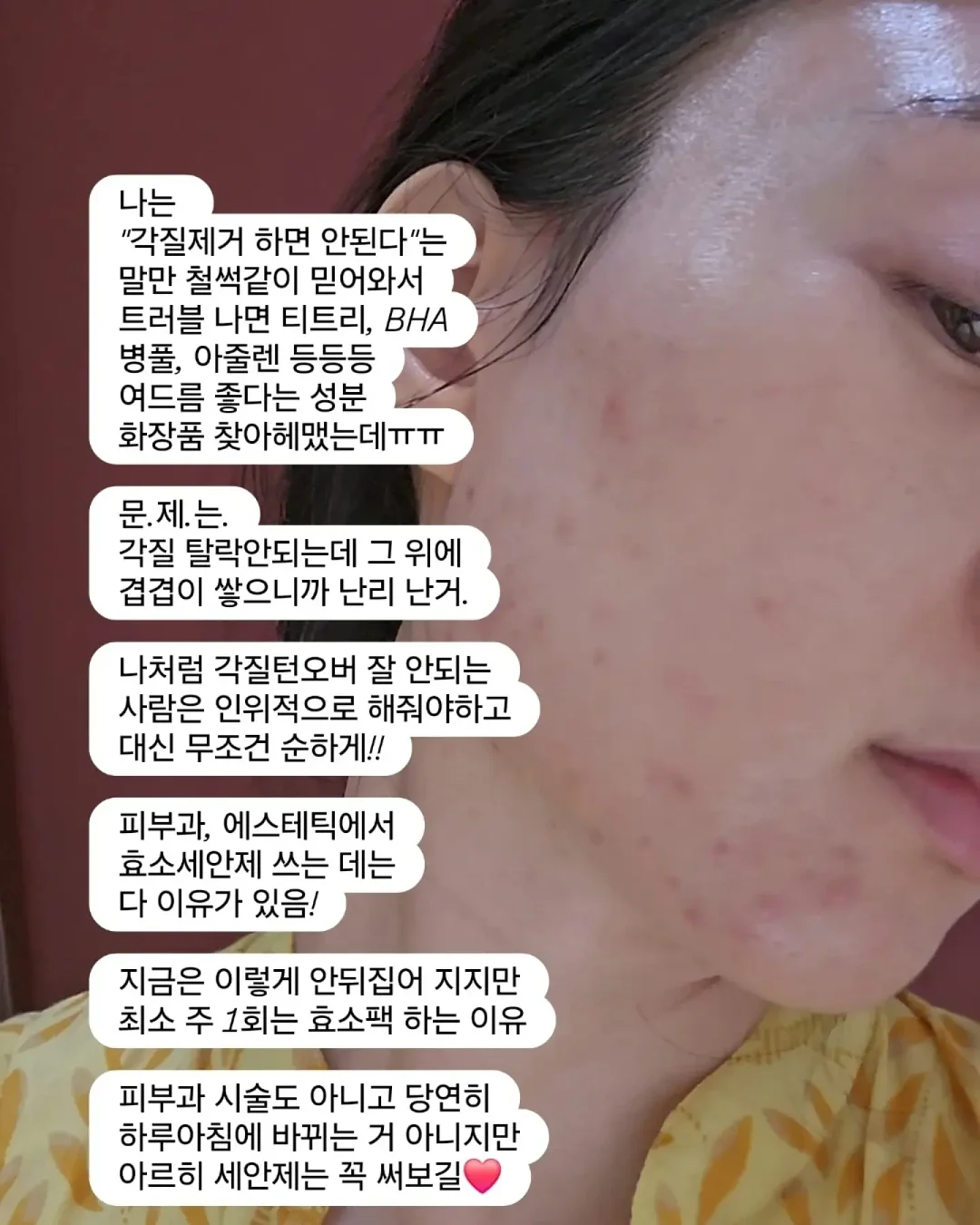 티셔츠 트레이 10