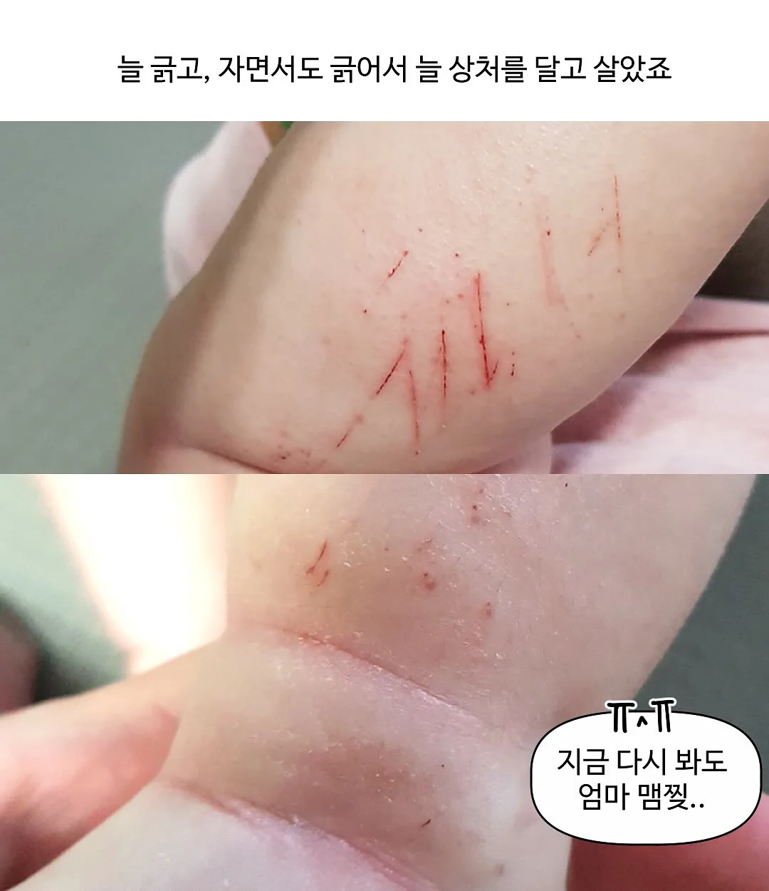 전동 유니슬랫 블라인드 3