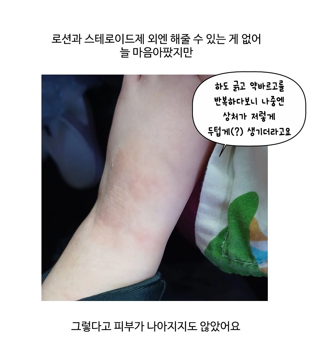 전동 유니슬랫 블라인드 4