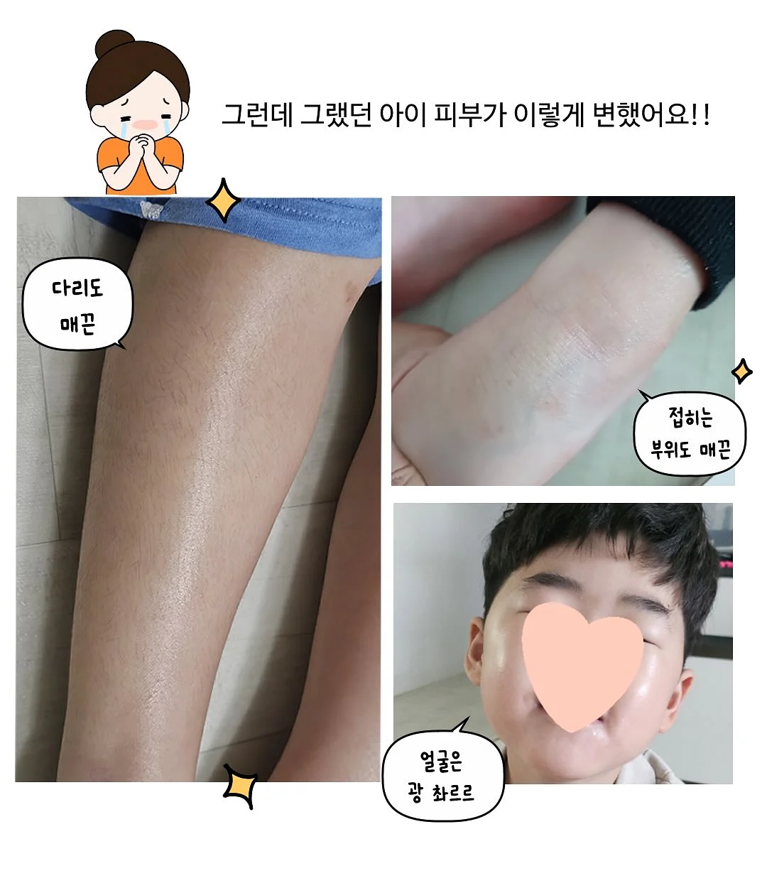 전동 유니슬랫 블라인드 5