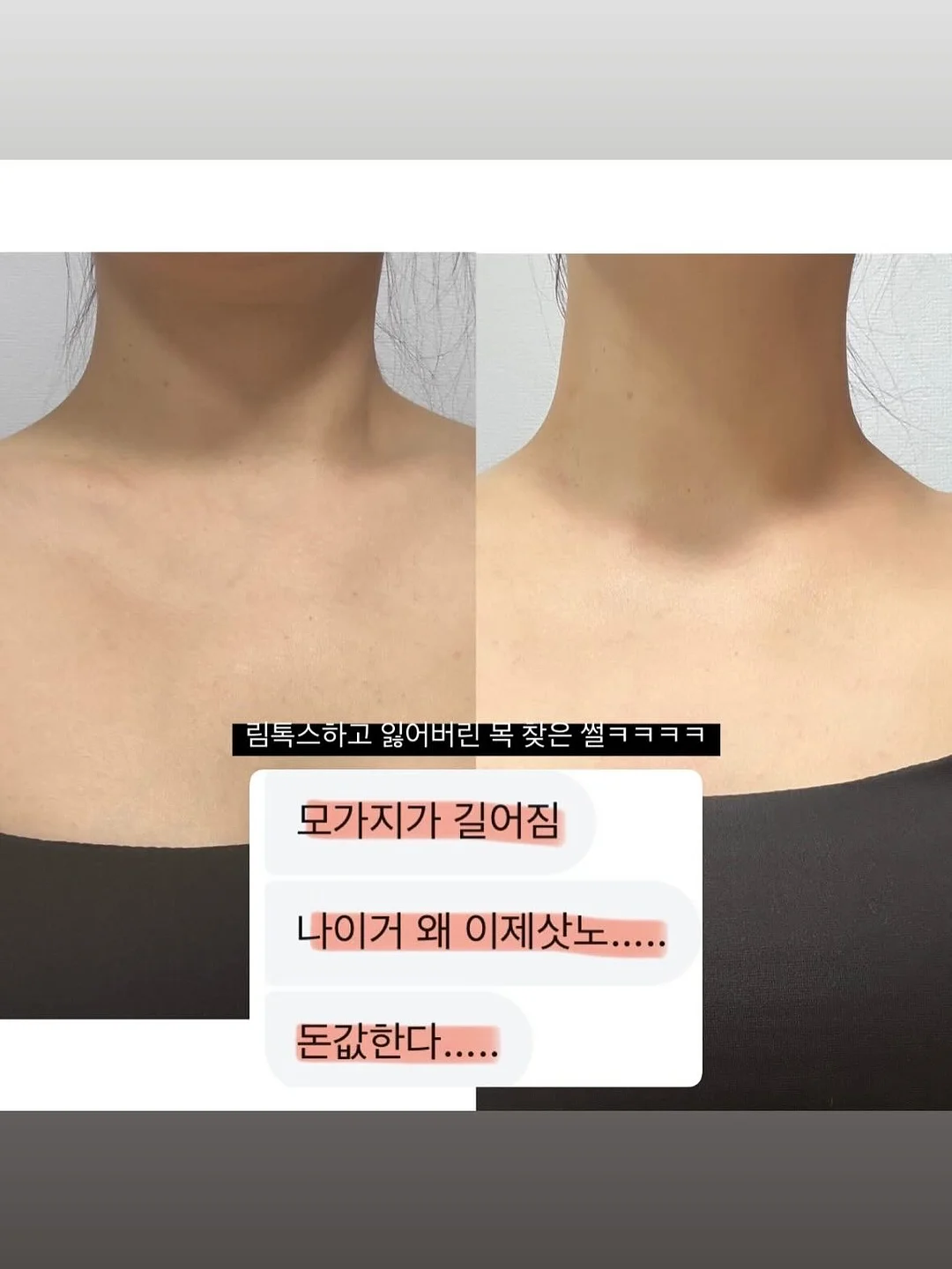 봄의 왈츠 키스컷 11