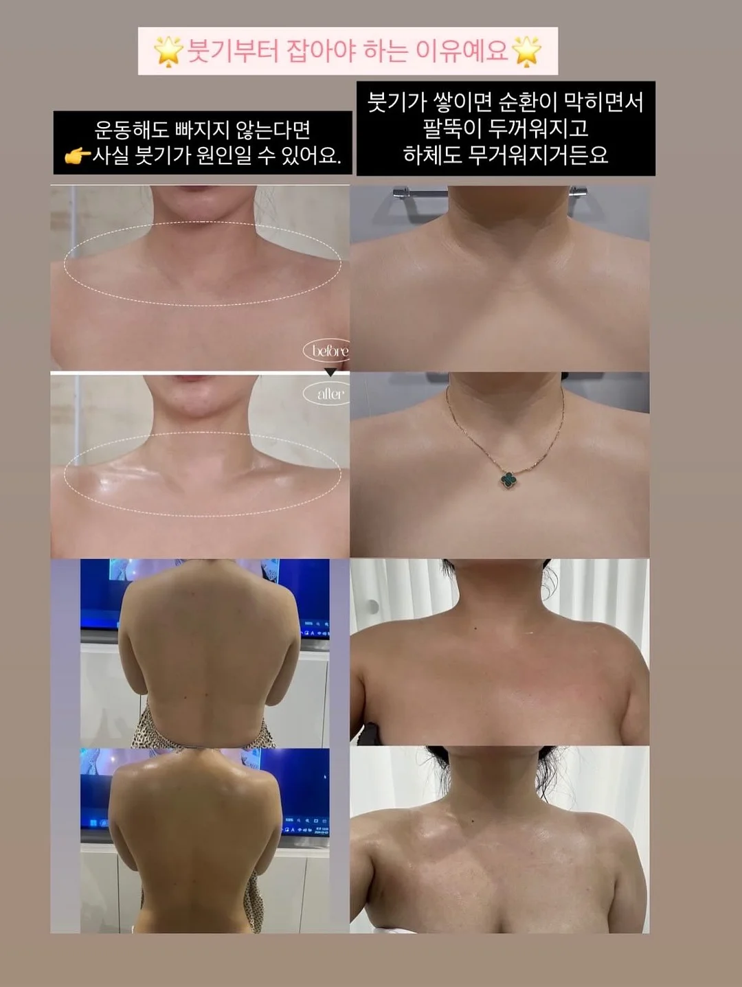 봄의 왈츠 키스컷 2