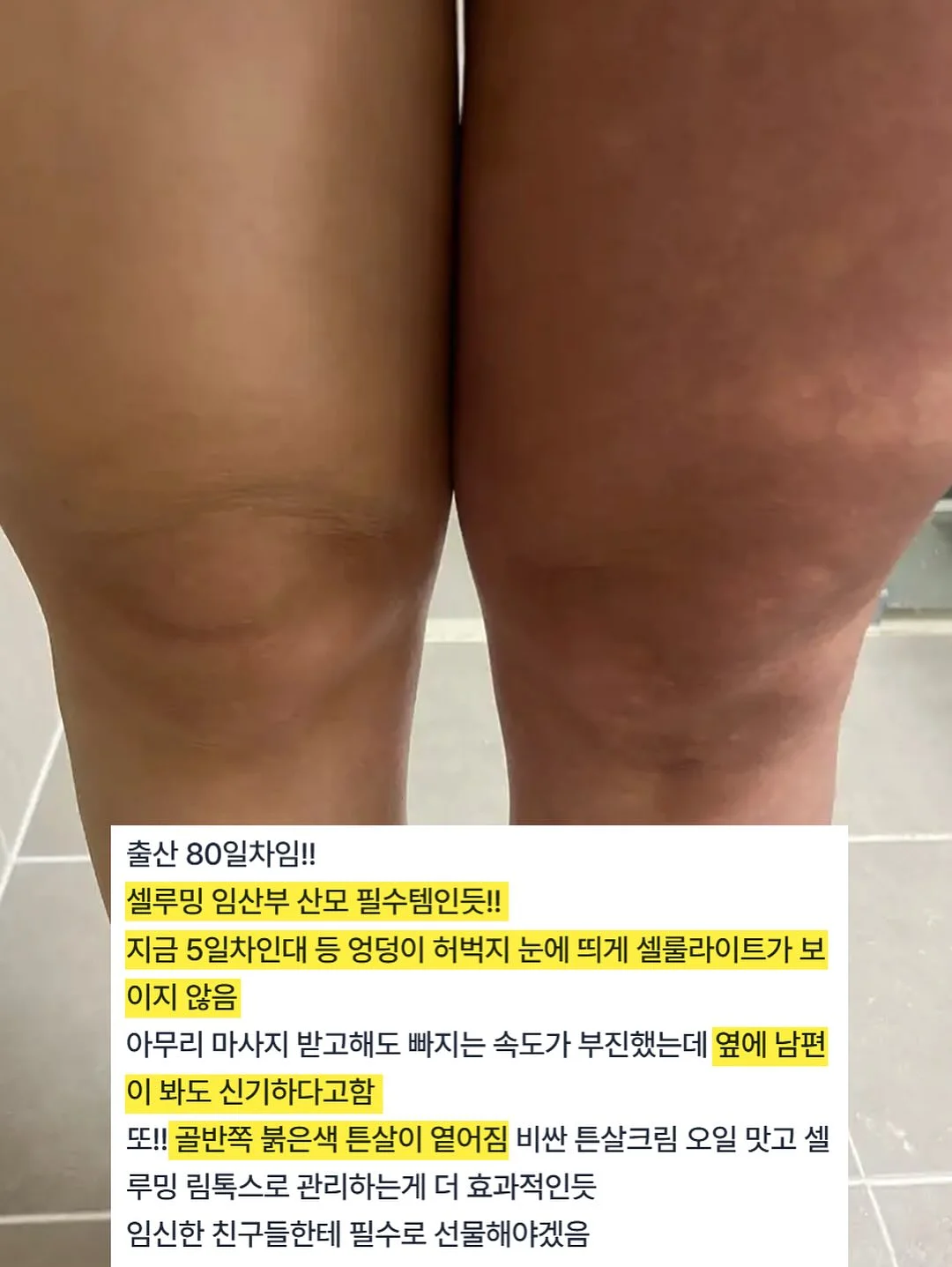 봄의 왈츠 키스컷 5