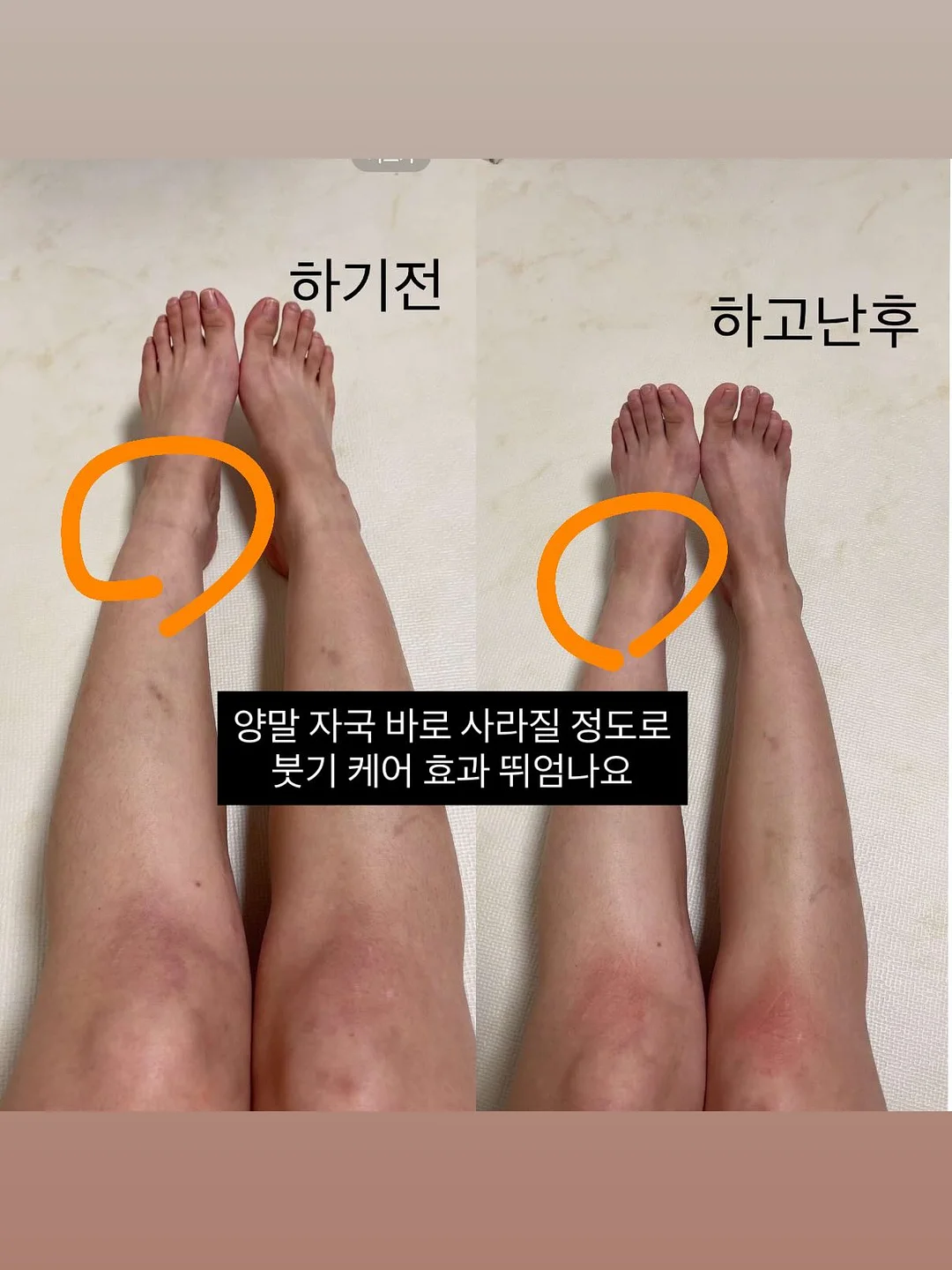봄의 왈츠 키스컷 7