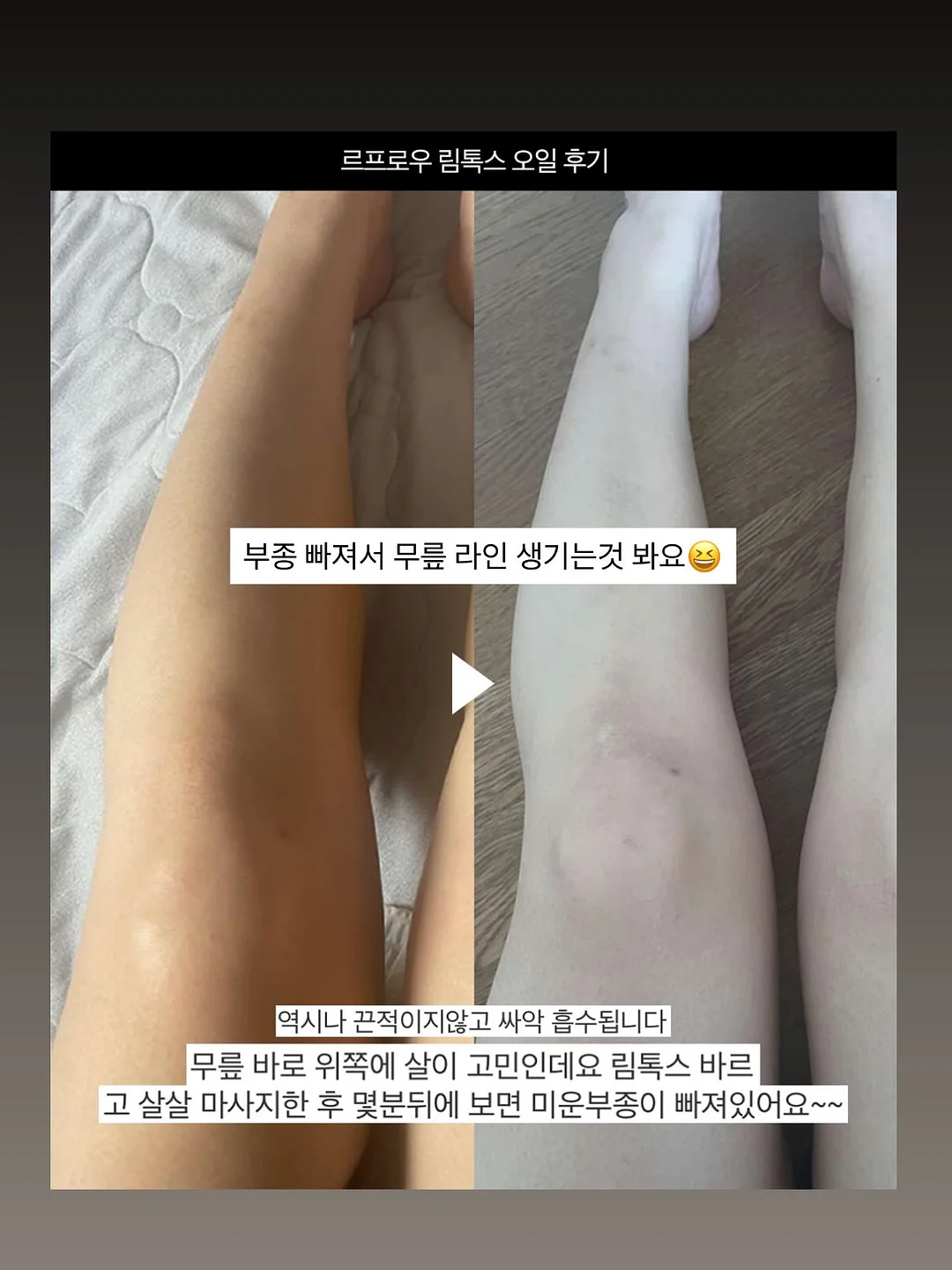 봄의 왈츠 키스컷 8