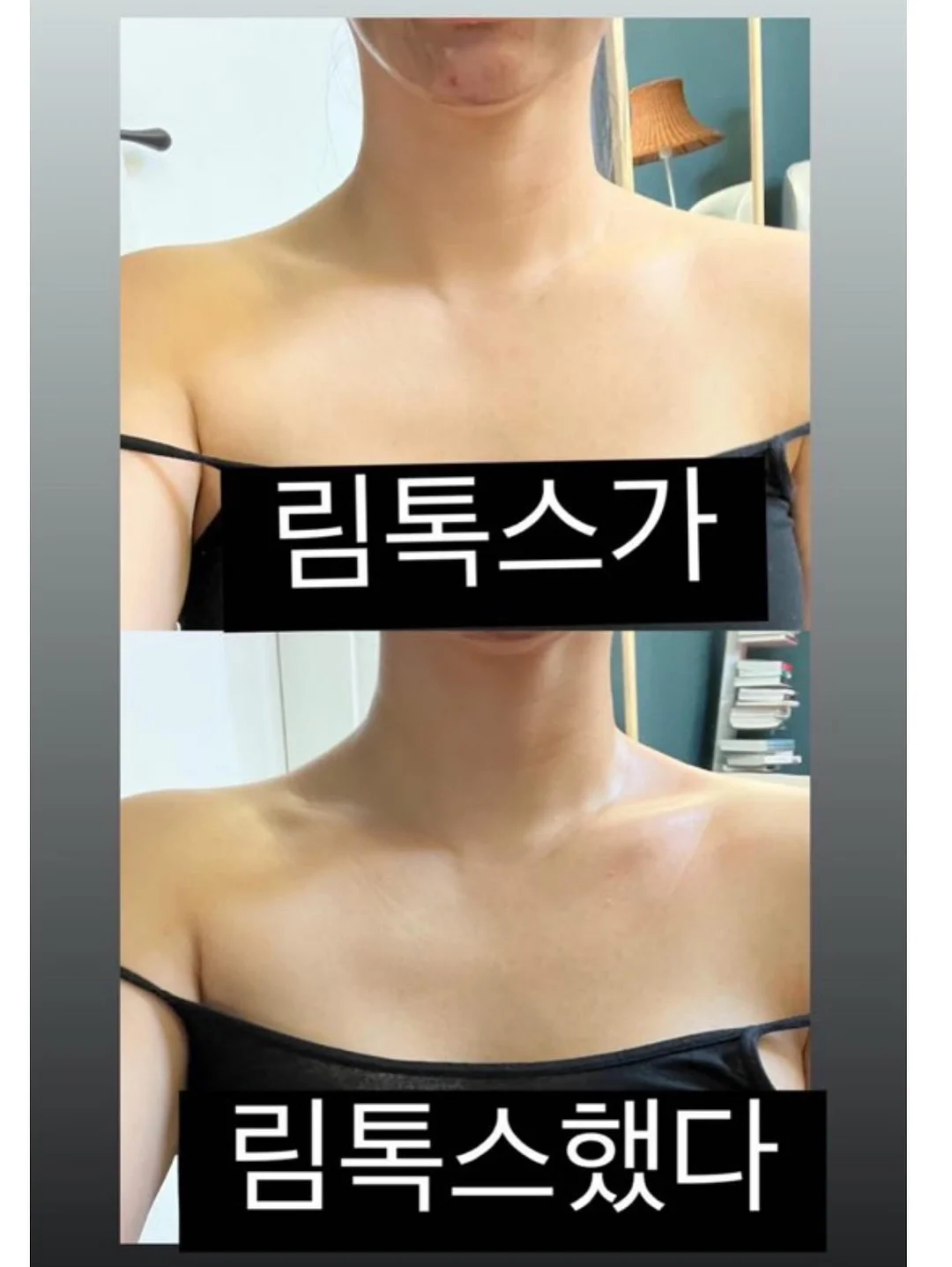 봄의 왈츠 키스컷 10