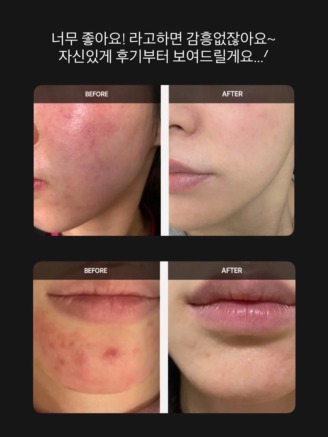 프리미엄 캡슐세제 5