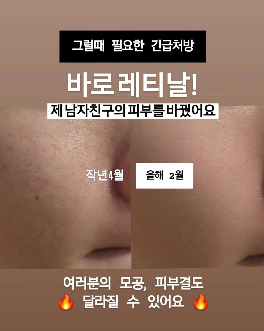 크록스 메리제인 발레슈즈 4