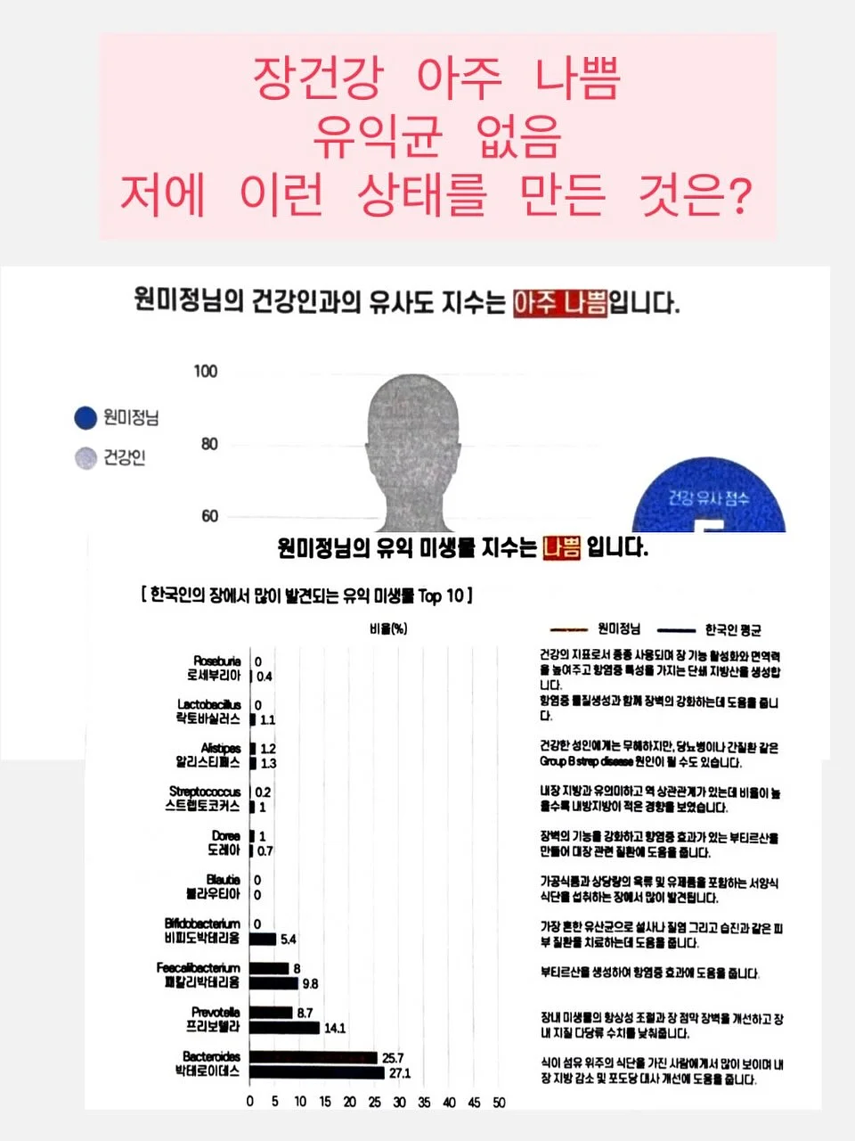 리페론 재생크림 3
