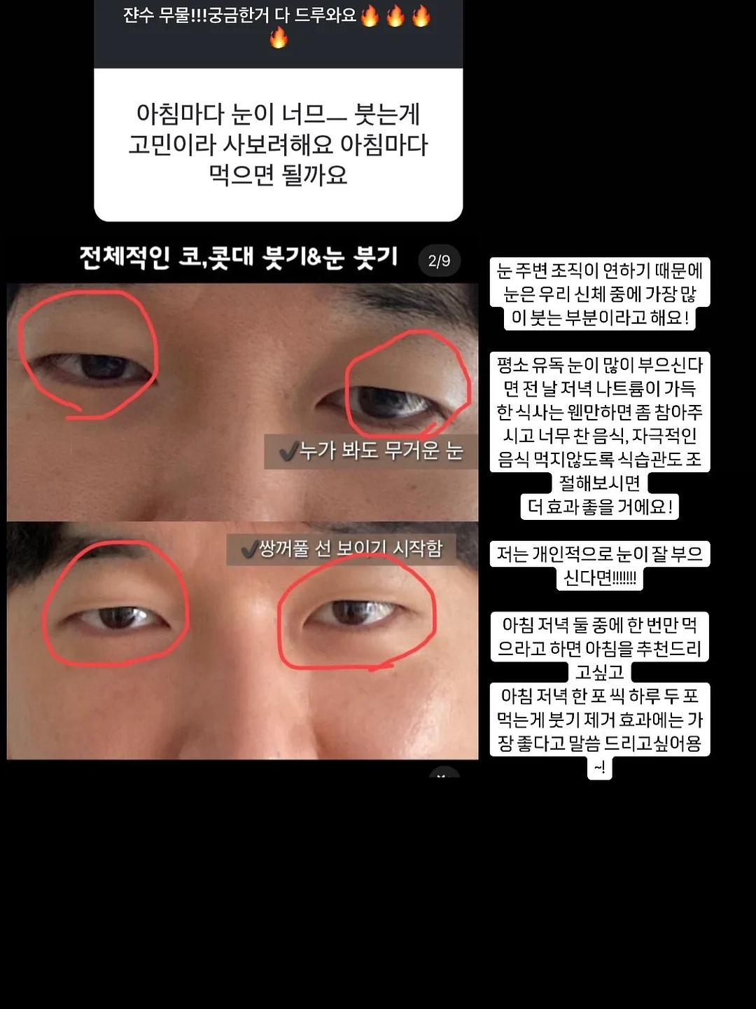 디녹 여름 블라우스 9