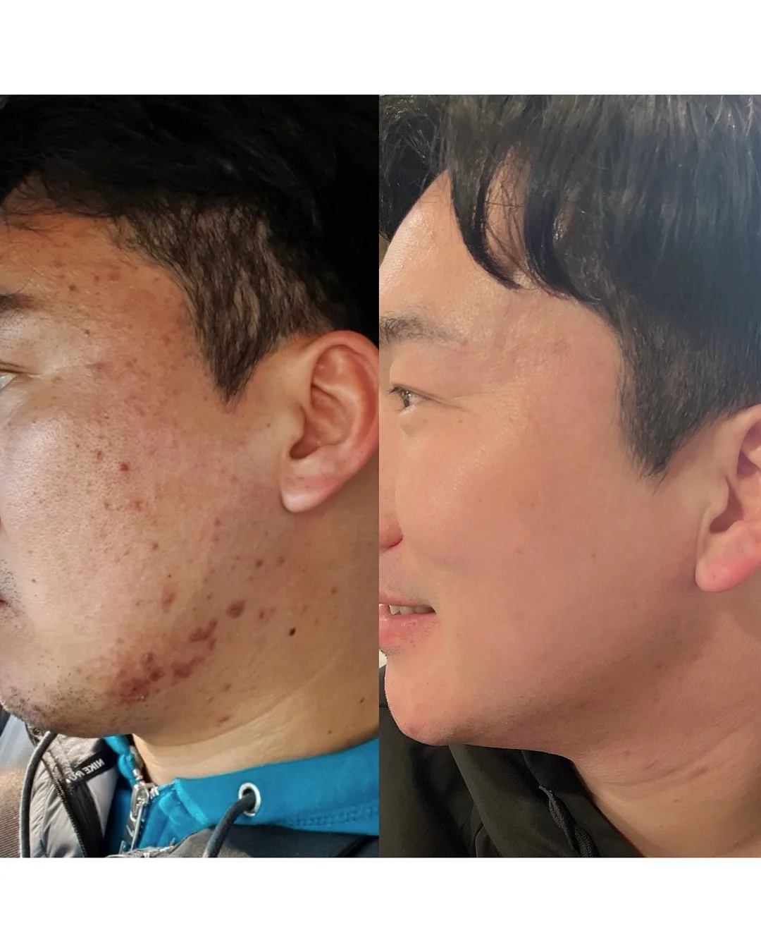 영양제 3종 11