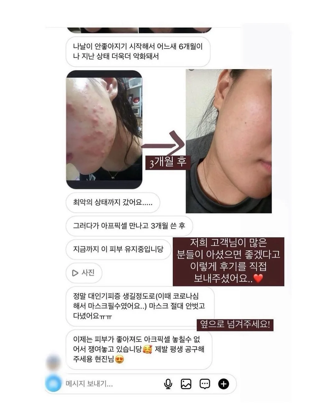 영양제 3종 3