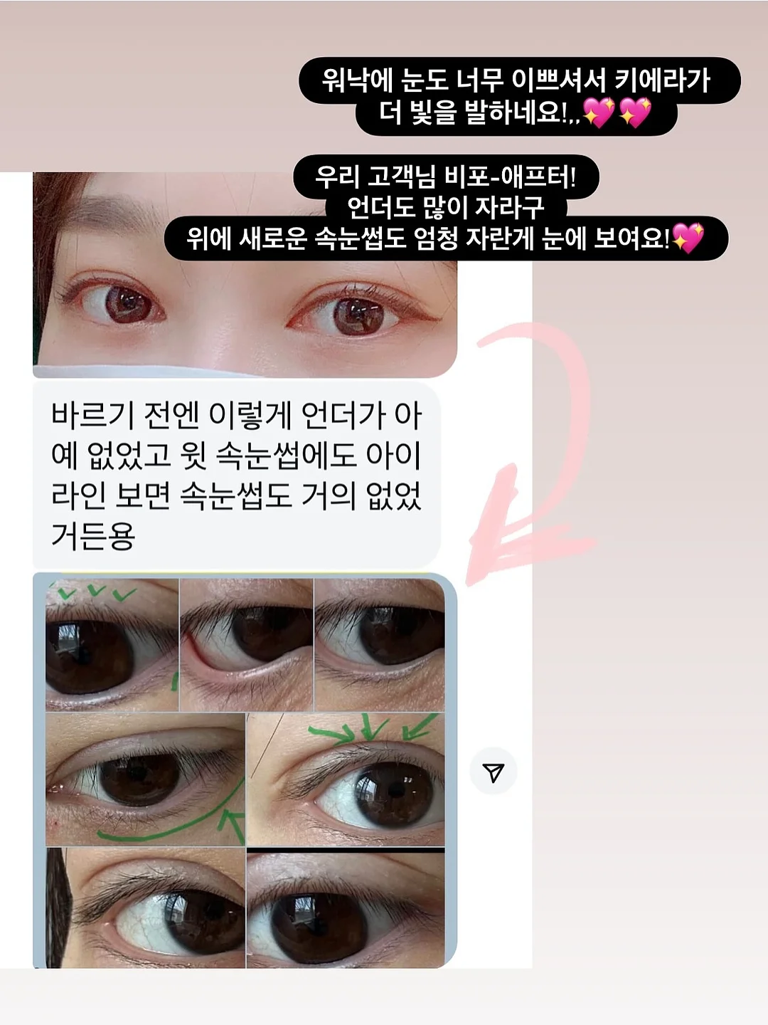볼펜 7