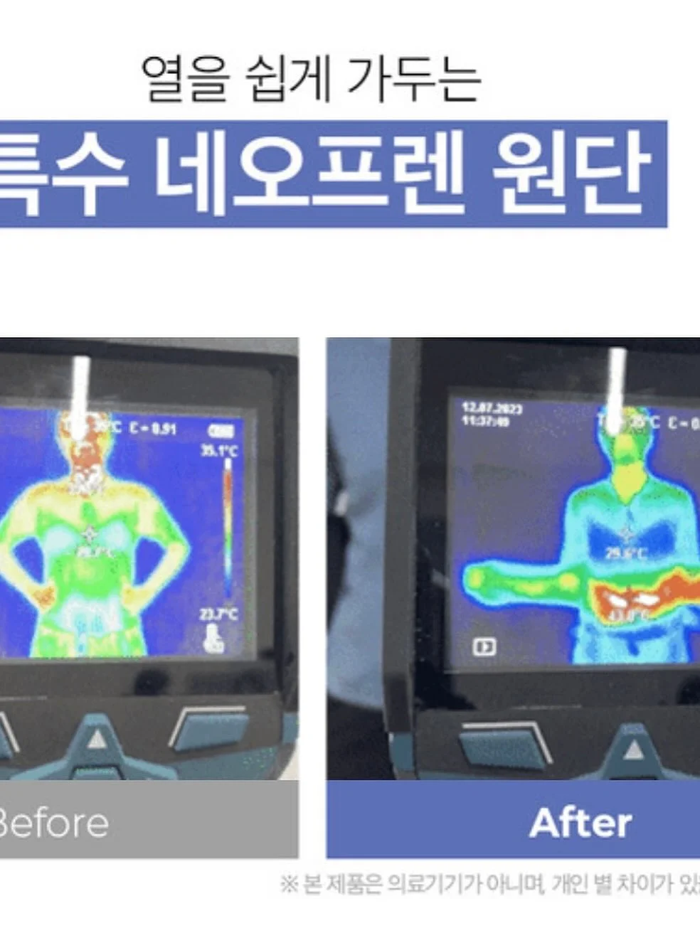 집게핀 7