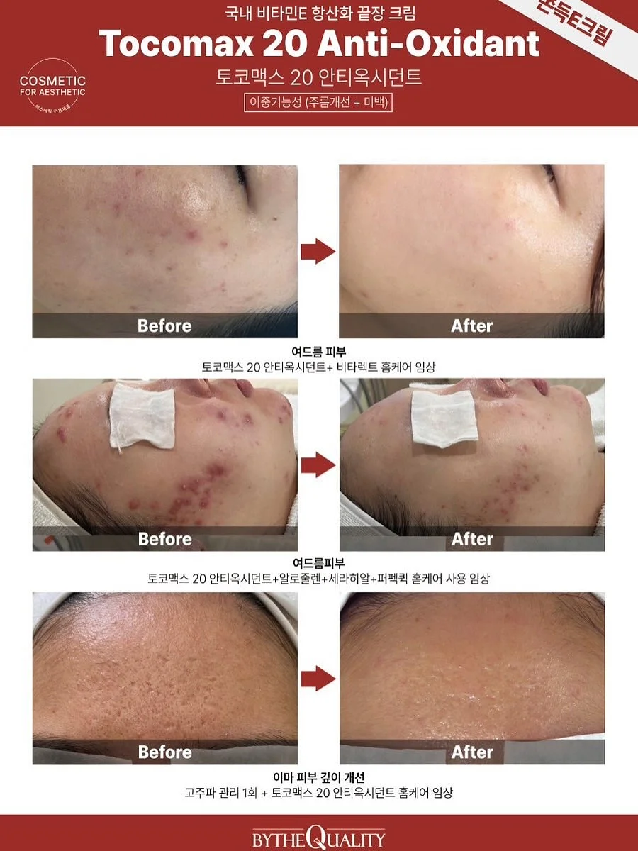 키티당고 딸기 프린팅 티셔츠 8