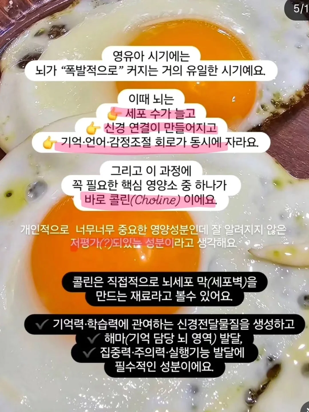 EMS 복부 벨트 3