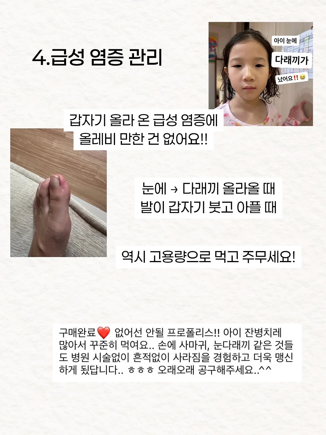 오뜨베베 리본 레이스 오버롤 5