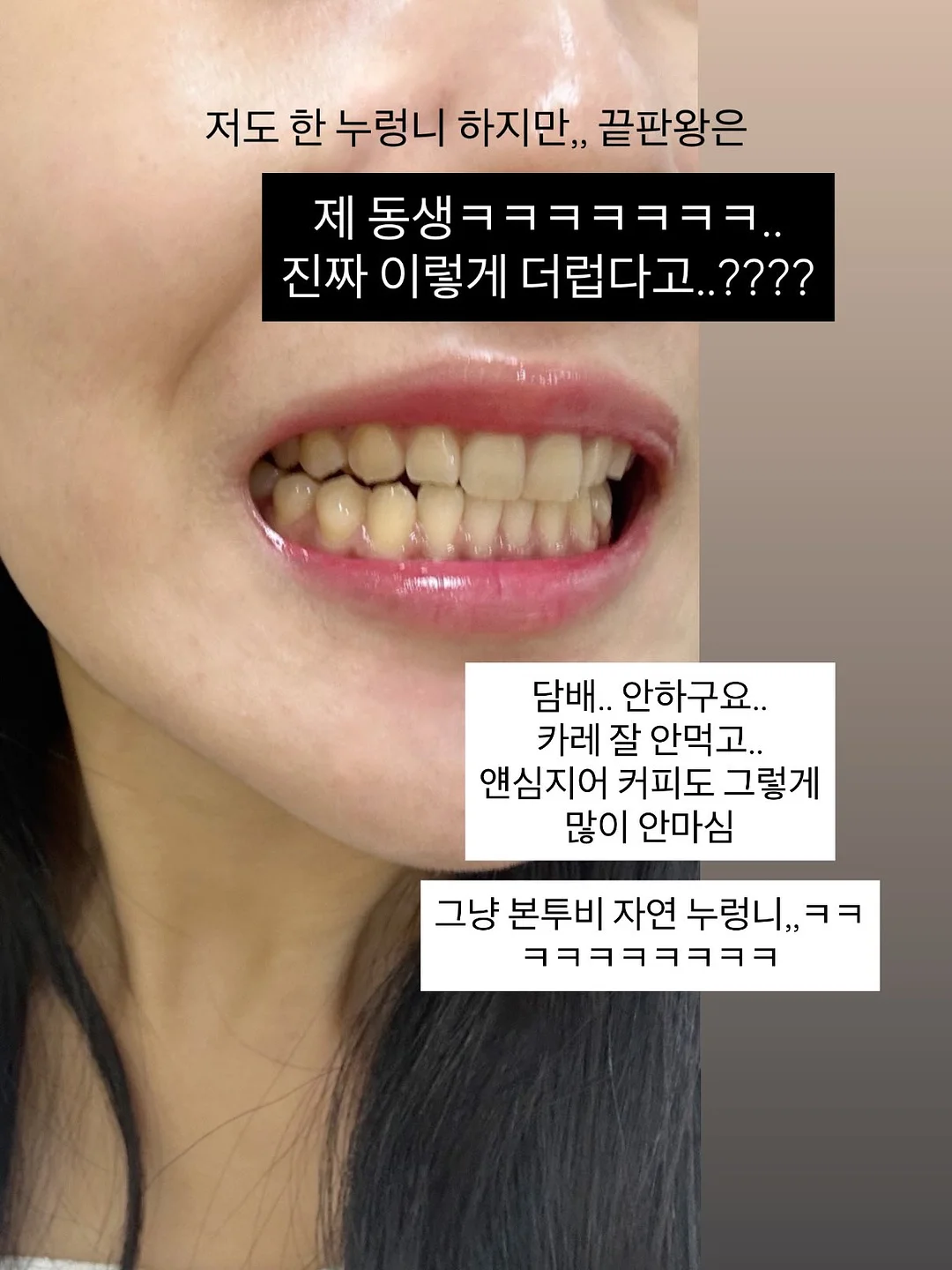 프레 스트라이프 프릴 팬츠 11