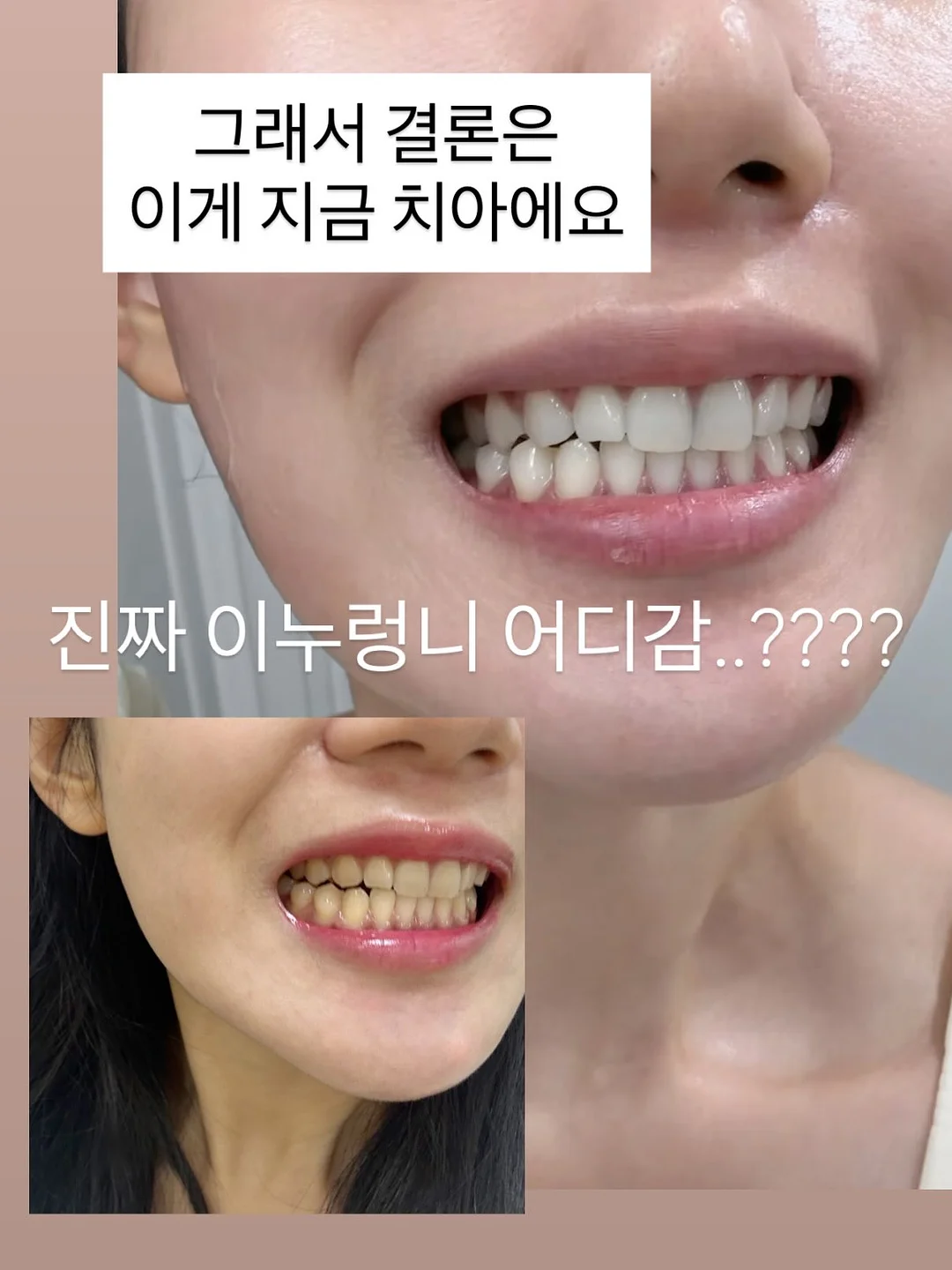 프레 스트라이프 프릴 팬츠 13