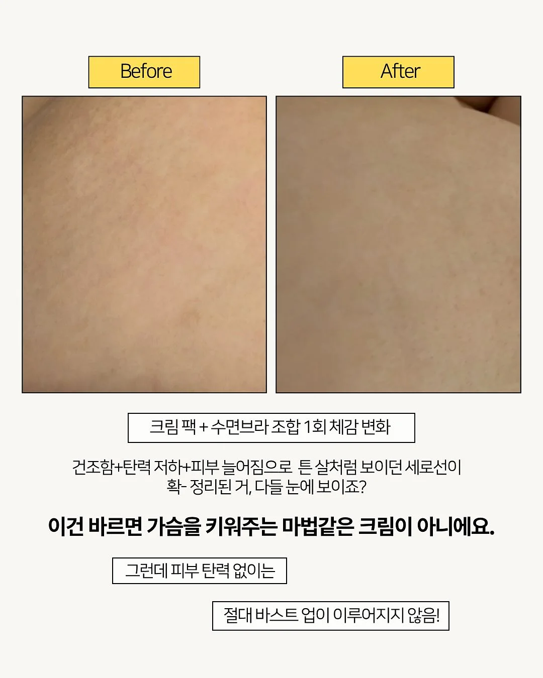 아큐민 3