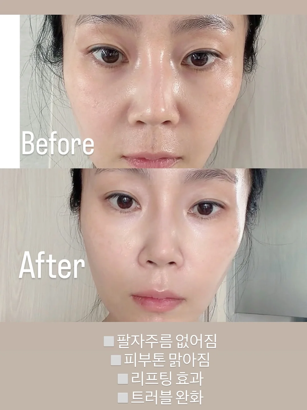 UV 살균기 5