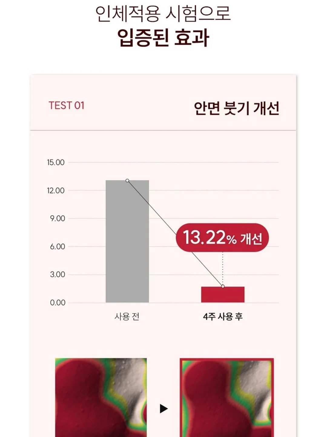 UV 살균기 8