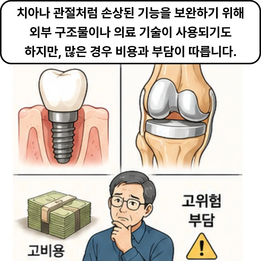 슈퍼젝션 홈키트 2