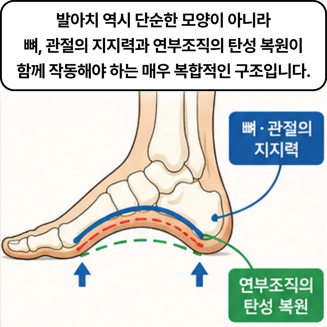 슈퍼젝션 홈키트 3