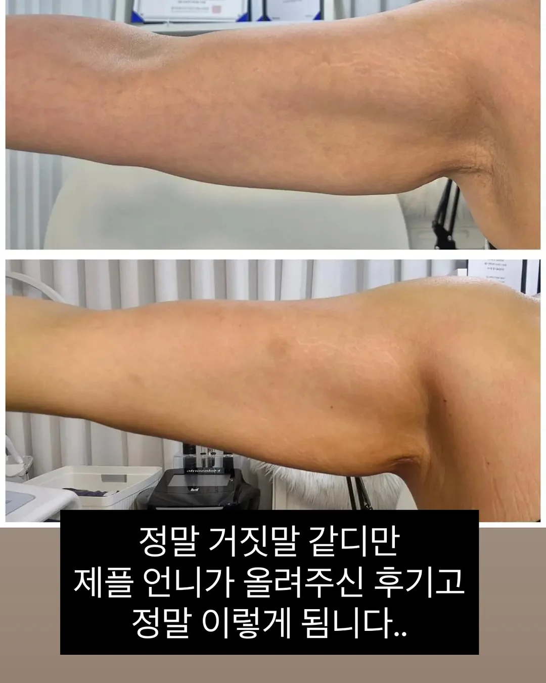 에델바이스 오이스터 컬렉션 접시 12