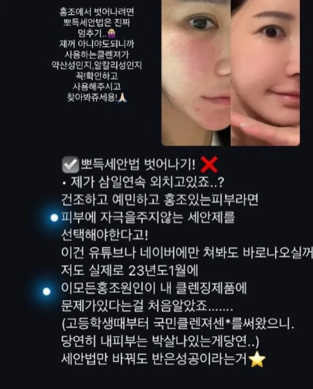 상하치즈 프로틴치즈 스트링 2