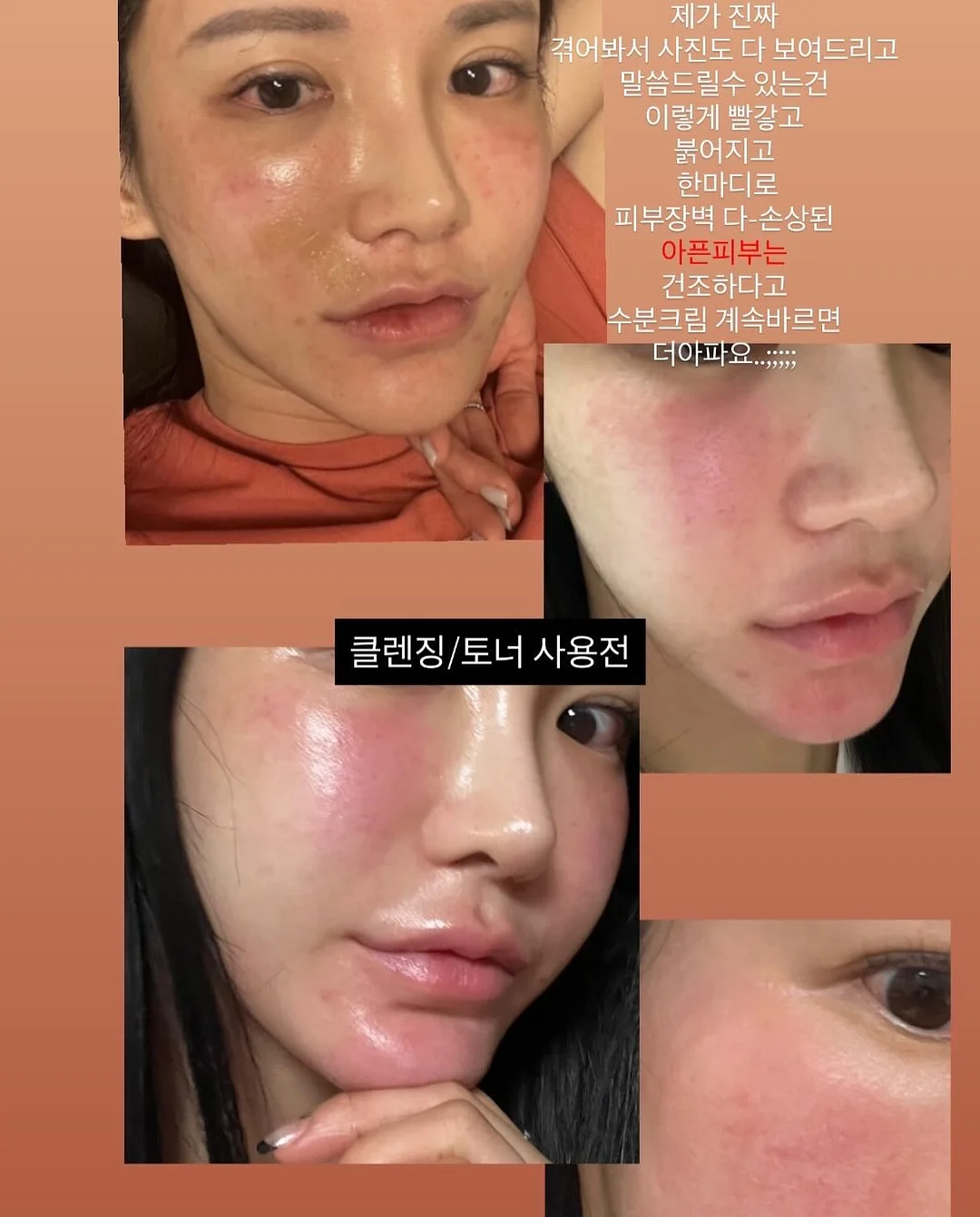 상하치즈 프로틴치즈 스트링 6