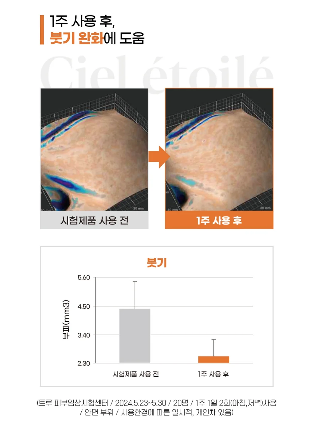 디그 잇 8