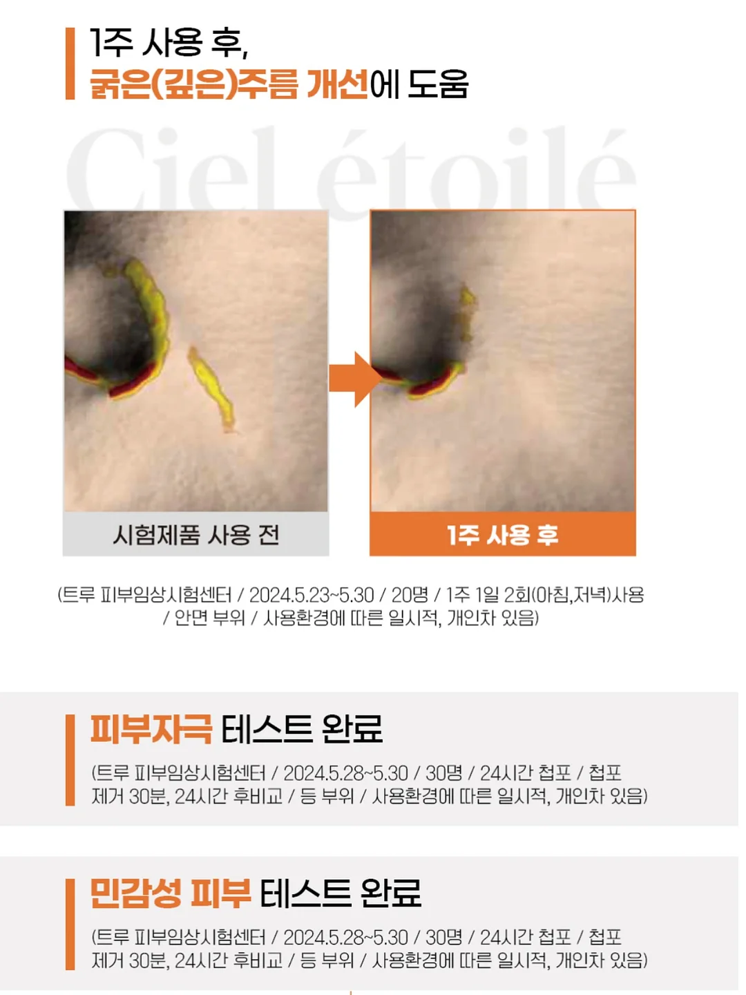 디그 잇 10