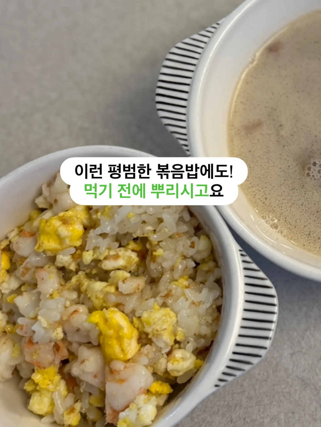 링클립 라운드 슬링백 3