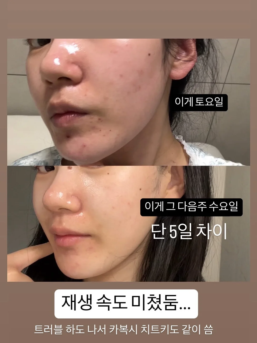 말더듬 쏙쏙 알기 교구 3