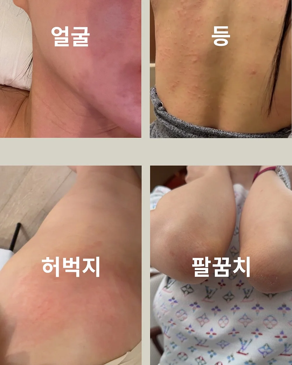 토퍼 9
