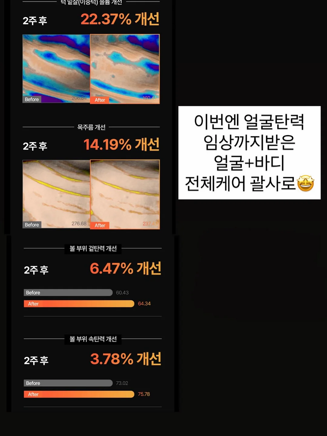 접이식 선반 14