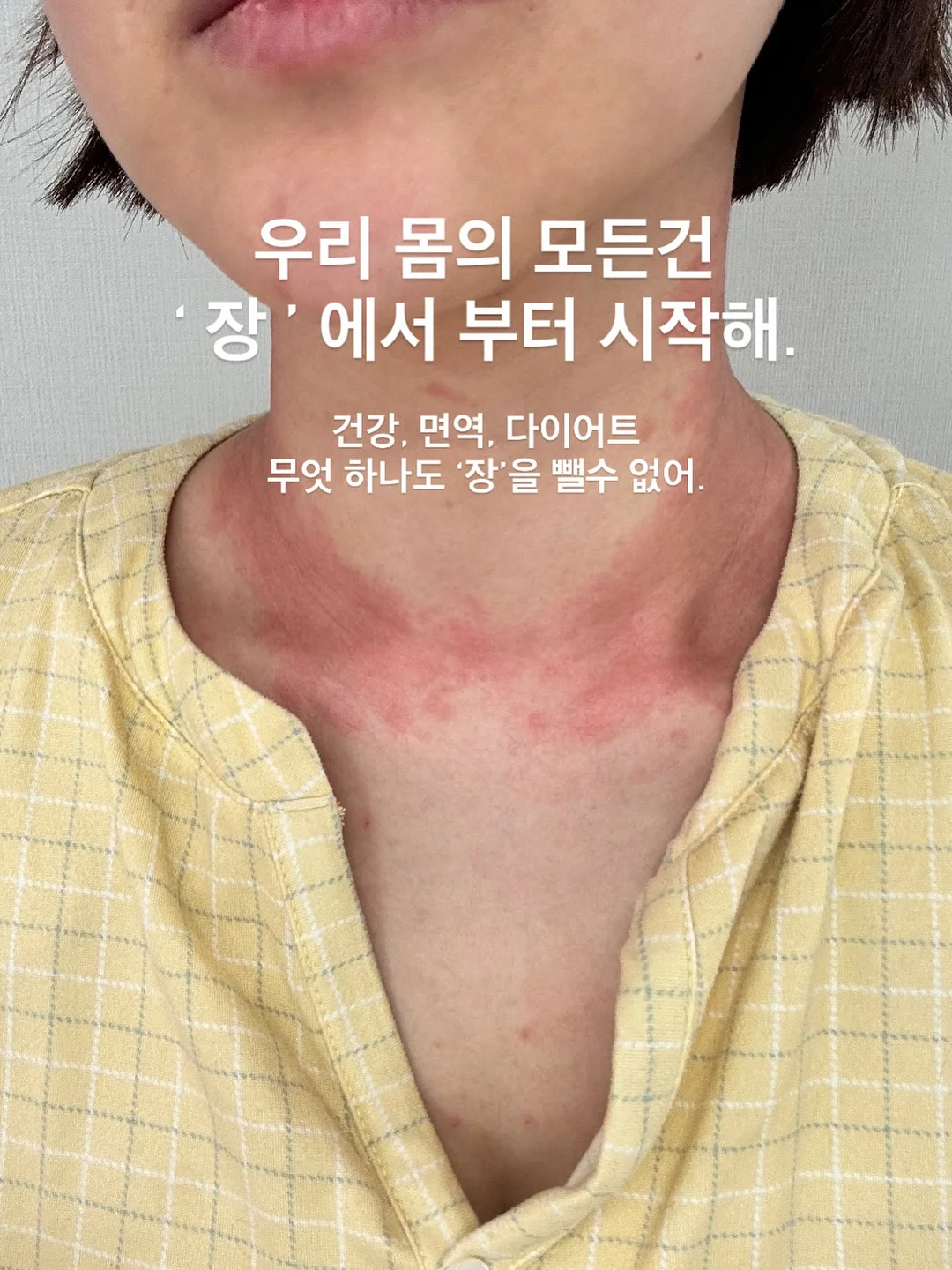 우리아이 6가지 대표고민 영양소 4